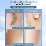 جهاز إزالة الشعر المنزلي IPL مع عدسات إضافية