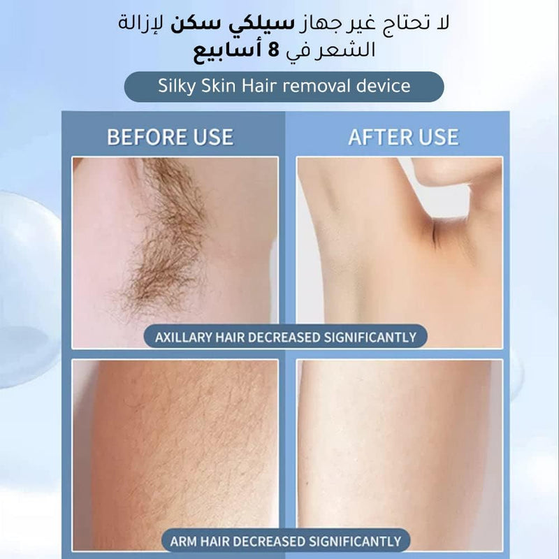 جهاز إزالة الشعر المنزلي IPL مع عدسات إضافية