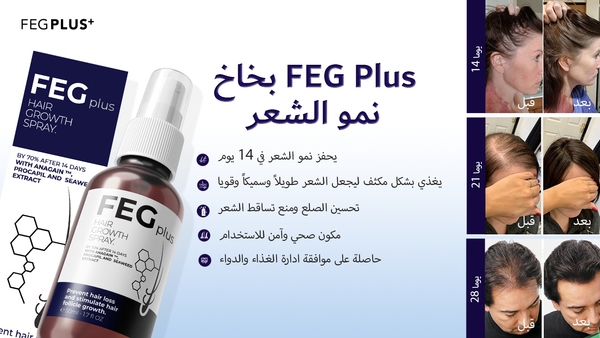 بخاخ FEG Plus للعناية بفروة الرأس والشعر