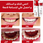 معجون اسنان مبيض SP-4