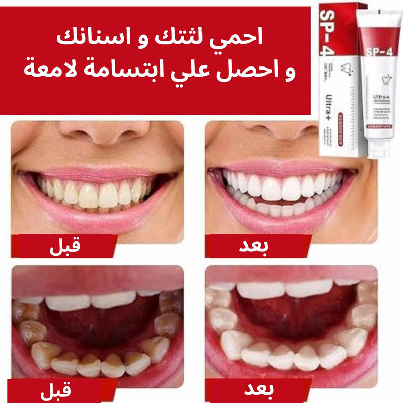 معجون اسنان مبيض SP-4
