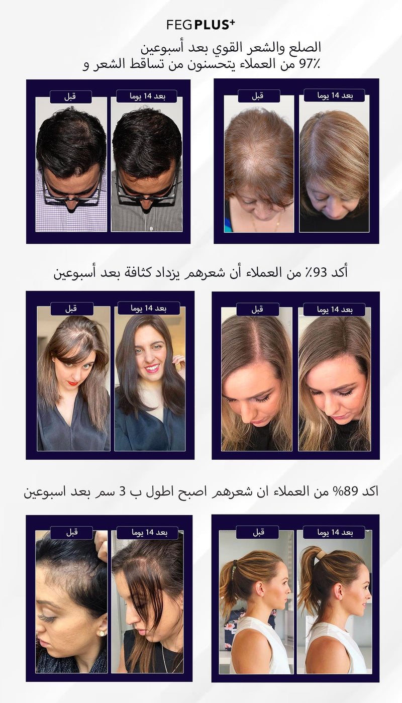 بخاخ FEG Plus للعناية بفروة الرأس والشعر